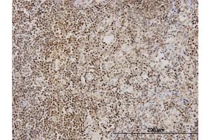 Immunoperoxidase of monoclonal antibody to TNKS on formalin-fixed paraffin-embedded human lymph node.