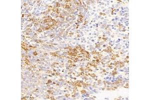 Immunohistochemistry of paraffin embedded mouse Immune spleen using IL-27A (ABIN7074367) at dilution of 1: 800 (400x lens)