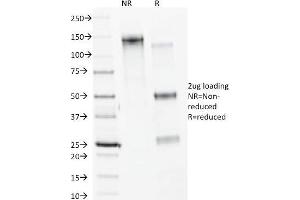SDS-PAGE Analysis Purified Calnexin Mouse Monoclonal Antibody (CANX/1541).