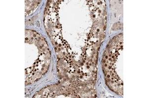 Immunohistochemical staining of human testis with TAS2R42 polyclonal antibody  shows strong nuclear positivity in cells of seminiferus ducts at 1:50-1:200 dilution. (TAS2R42 anticorps)