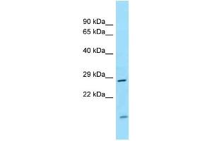 WB Suggested Anti-CD82 Antibody Titration: 1. (CD82 anticorps  (Middle Region))