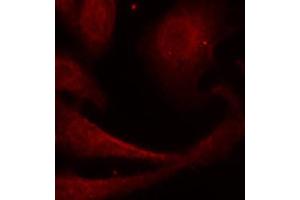 Immunofluorescence (IF) image for anti-Nuclear Factor-kB p65 (NFkBP65) (pSer529) antibody (ABIN1870581) (NF-kB p65 anticorps  (pSer529))