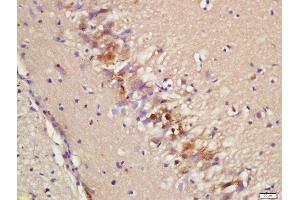 Formalin-fixed and paraffin embedded rat brain labeled with Rabbit Anti-Epac2 Polyclonal Antibody, Unconjugated (ABIN2173847) at 1:200 followed by conjugation to the secondary antibody and DAB staining (RAPGEF4 anticorps  (AA 151-250))