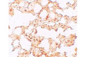 Immunohistochemical staining of mouse lung cells with SLC39A6 polyclonal antibody  at 5 ug/mL. (SLC39A6 anticorps  (Internal Region))