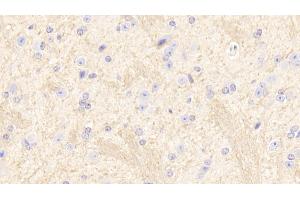 Detection of SIRT2 in Mouse Cerebrum Tissue using Polyclonal Antibody to Sirtuin 2 (SIRT2) (SIRT2 anticorps  (AA 65-340))
