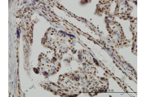 Immunoperoxidase of monoclonal antibody to MSI1 on formalin-fixed paraffin-embedded human placenta.