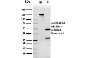 SDS-PAGE Analysis Purified G-CSF Recombinant Mouse Monoclonal Antibody (rCSF3/900).
