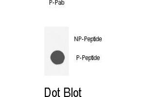 Dot blot analysis of anti-AKT1-p Phospho-specific Pab (ABIN389509 and ABIN2839564) on nitrocellulose membrane.