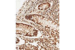Immunohistochemical analysis of paraffin-embedded Human colon tissue using A performed on the Leica® BOND RXm. (SNRPD3 anticorps  (N-Term))