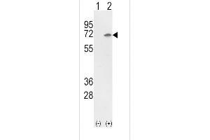 Western blot analysis of Ku70 (arrow) using rabbit polyclonal Ku70 Antibody (Center) (ABIN652244 and ABIN2841008).