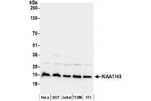 Western Blotting (WB) image for anti-KIAA1143 (KIAA1143) (AA 104-154) antibody (ABIN7449890)