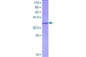 Image no. 1 for Fibrillin 1 (FBN1) (AA 2772-2871) protein (GST tag) (ABIN1353704)
