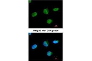 ICC/IF Image Immunofluorescence analysis of paraformaldehyde-fixed HeLa, using U2AF35, antibody at 1:200 dilution. (U2AF1 anticorps)