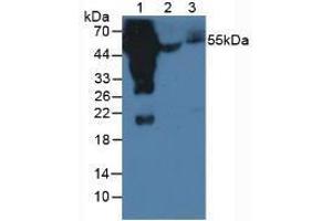 Western blot analysis of (1) Human Serum, (2) Porcine Serum and (3) Mouse Serum. (Lapin anti-Humain IgG4 (AA 222-327) Anticorps)