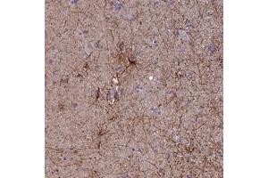 Immunohistochemical staining of human hippocampus with USP37 polyclonal antibody  shows distinct cytoplasmic positivity in astrocytes at 1:10-1:20 dilution. (USP37 anticorps)