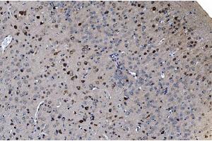 IHC analysis of GABARAP using anti-GABARAP antibody (ABIN7603159). (GABARAP anticorps  (N-Term))