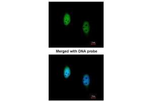 ICC/IF Image Immunofluorescence analysis of paraformaldehyde-fixed HeLa, using TBLR1 , antibody at 1:200 dilution.