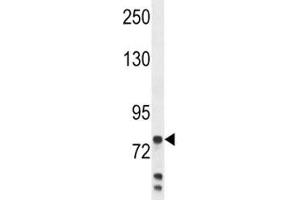 Anti-Myeloperoxidase antibody western blot analysis in MDA-MB231 lysate.