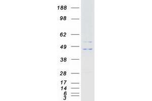 Validation with Western Blot