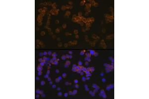 Immunofluorescence analysis of Jurkat cells using WASP Rabbit mAb (ABIN7271381) at dilution of 1:100 (40x lens).