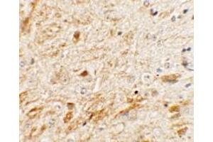 Immunohistochemistry of TMEM106A in mouse brain tissue with TMEM106A Antibody at 5 µg/ml. (TMEM106A anticorps  (N-Term))
