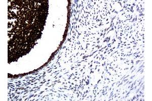 Image no. 1 for anti-WAP Four-Disulfide Core Domain 2 (WFDC2) (AA 31-124) antibody (ABIN1491389)