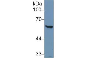 Detection of G6PD in Human Hela cell lysate using Polyclonal Antibody to Glucose-6-phosphate Dehydrogenase (G6PD)