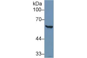 Detection of G6PD in Human Hela cell lysate using Polyclonal Antibody to Glucose-6-phosphate Dehydrogenase (G6PD) (Glucose-6-Phosphate Dehydrogenase anticorps)