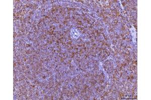 IHC analysis of Ccl3 using anti-Ccl3 antibody (ABIN7600860).