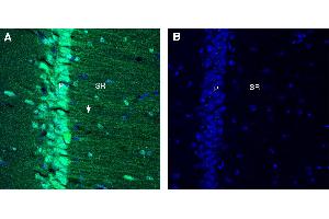 anti-Glycine Transporter 1 (GLYT1) (2nd Extracellular Loop), (AA 202-214) antibody