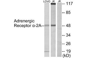 Western Blotting (WB) image for anti-Alpha-2A Adrenergic Receptor (ADRA2A) (C-Term) antibody (ABIN1849124) (ADRA2A anticorps  (C-Term))