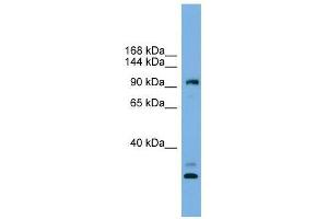 CCDC110 antibody used at 0. (CCDC110 anticorps  (Middle Region))