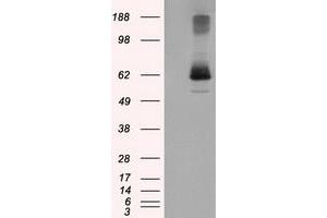 HEK293T cells were transfected with the pCMV6-ENTRY control (Left lane) or pCMV6-ENTRY LIPG (Right lane) cDNA for 48 hrs and lysed. (LIPG anticorps)