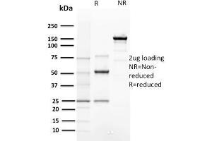 SDS-PAGE Analysis Purified Cyclin E Mouse Monoclonal Antibody (CCNE1/2460).