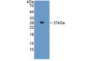 Western blot analysis of recombinant Human FGF19. (FGF19 anticorps  (AA 4-216))