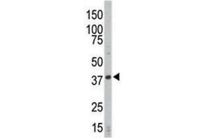 Western blot analysis of CDK4 antibody and HL-60 cell lysate