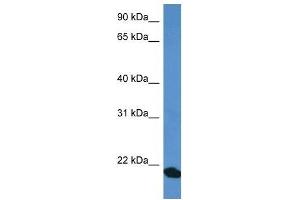 Western Blot showing COMMD1 antibody used at a concentration of 1 ug/ml against Fetal Heart Lysate (COMMD1 anticorps  (C-Term))