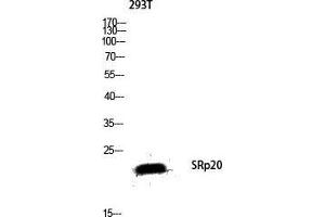 Western Blot (WB) analysis of 293T lysis using SRp20 antibody.