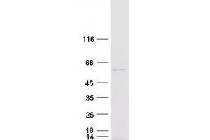 Validation with Western Blot