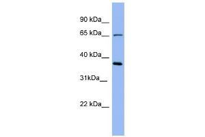 Uromodulin antibody used at 1 ug/ml to detect target protein. (Uromodulin anticorps  (Middle Region))