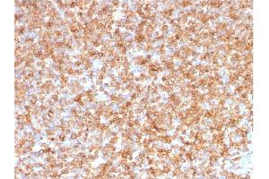 Formalin-fixed, paraffin-embedded human Tonsil stained with HLA- Pan Mouse Monoclonal Antibody (CR3/43). (MHC Class II HLA-DP/DQ/DR anticorps)