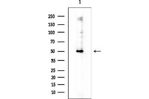 anti-DENN Domain Containing 11 (DENND11) antibody