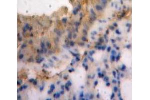IHC-P analysis of Lung tissue, with DAB staining. (SEMA3E anticorps  (AA 581-669))