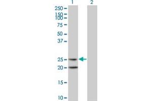 Western Blot analysis of IL6 expression in transfected 293T cell line by IL6 monoclonal antibody (M06), clone 4H5. (IL-6 anticorps  (AA 29-212))