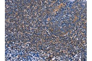 The image on the left is immunohistochemistry of paraffin-embedded Human tonsil tissue using ABIN7128290(AGFG1 Antibody) at dilution 1/60, on the right is treated with fusion protein. (AGFG1 anticorps)