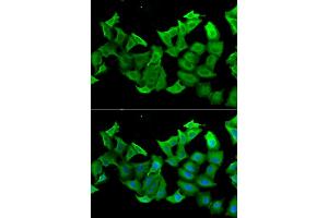 Immunofluorescence analysis of A549 cells using HAGH antibody (ABIN5973978). (HAGH anticorps)