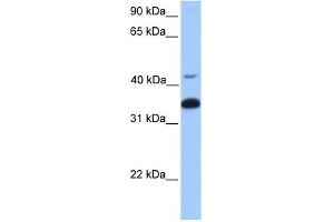 GNB2 antibody used at 1 ug/ml to detect target protein.