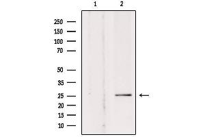 Western blot analysis of extracts from rat brain, using SOD-3  Antibody.