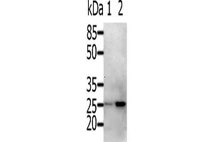 Western Blotting (WB) image for anti-RAB5A, Member RAS Oncogene Family (RAB5A) antibody (ABIN2425529) (RAB5 anticorps)