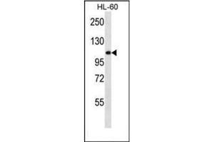 Western blot analysis of Alpha-glucosidase Antibody (N-term) in HL-60 cell line lysates (35ug/lane). (AGLU anticorps  (N-Term))